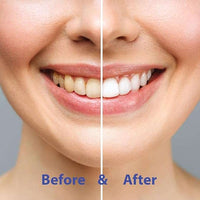 Super Whitening Peppermint NHAP Toothpaste Tablets