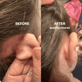 Skin Saver for Tweens