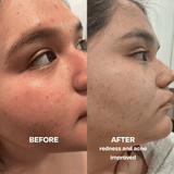 Skin Saver for Tweens